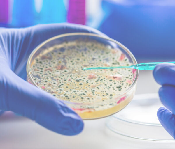 Microbial nutrition
